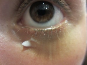 anti cerne sur ma peau